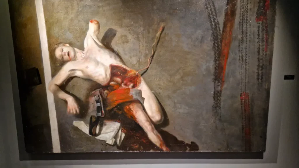 Amputation på Nerdrum Museum